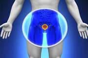 سرطان پروستات دومین سرطان کشنده در مردان 